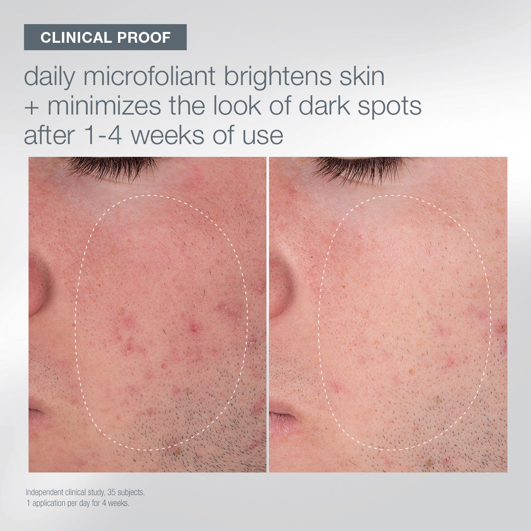 home for the holidays (4 travel-size + bag)