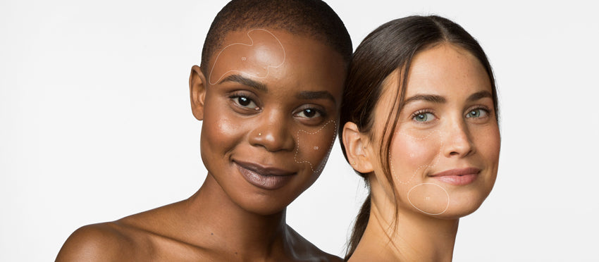 q&a: does skin tone impact skin care?