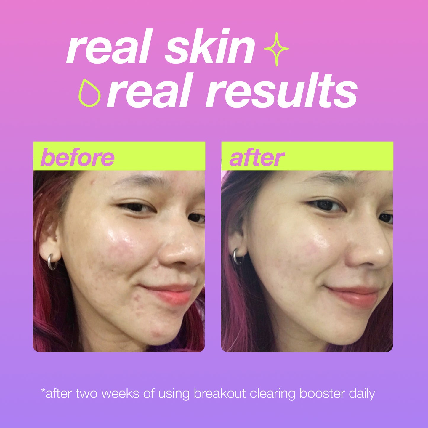 breakout clearing duo