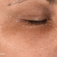 melanopro peel system
