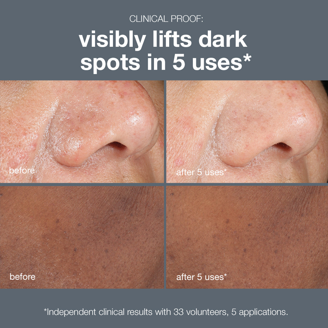 rapid radiance routine