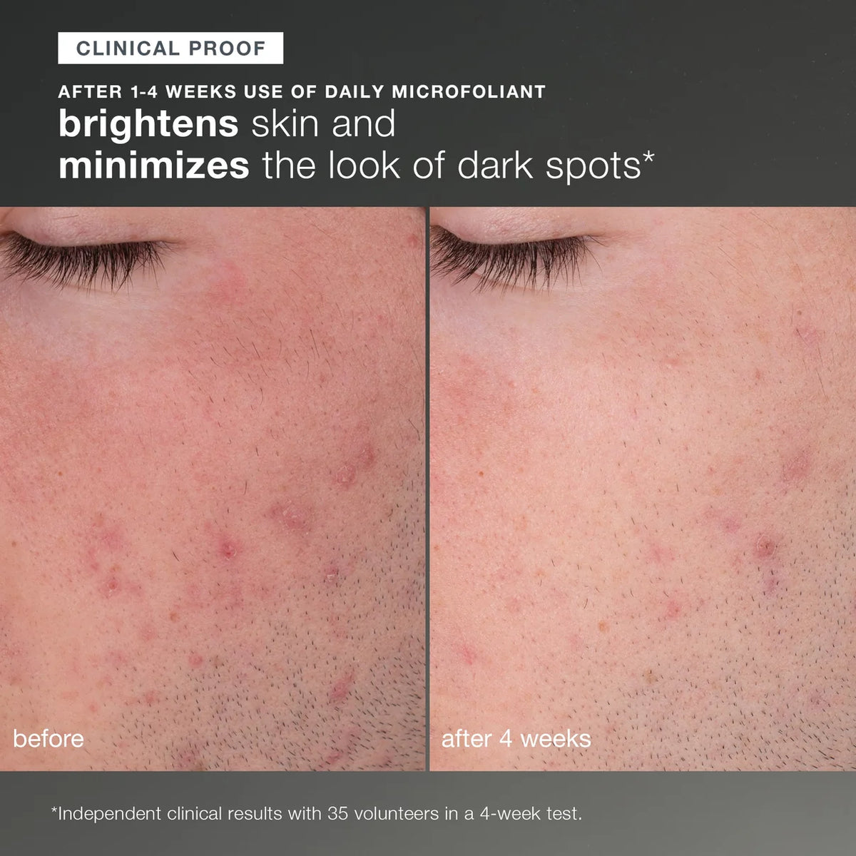 discover healthy skin kit