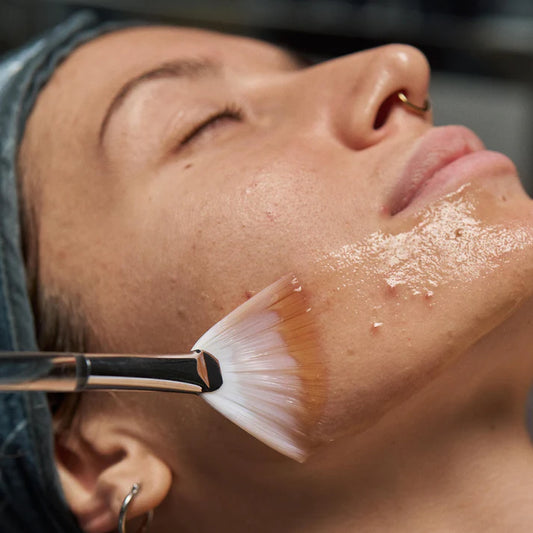 pro clear skin treatment