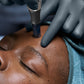 PRO microneedling masterclass