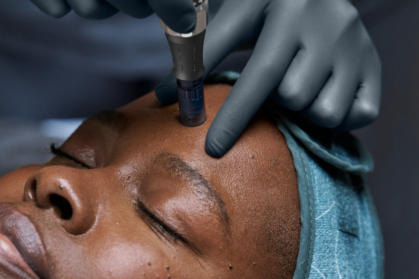 PRO microneedling masterclass
