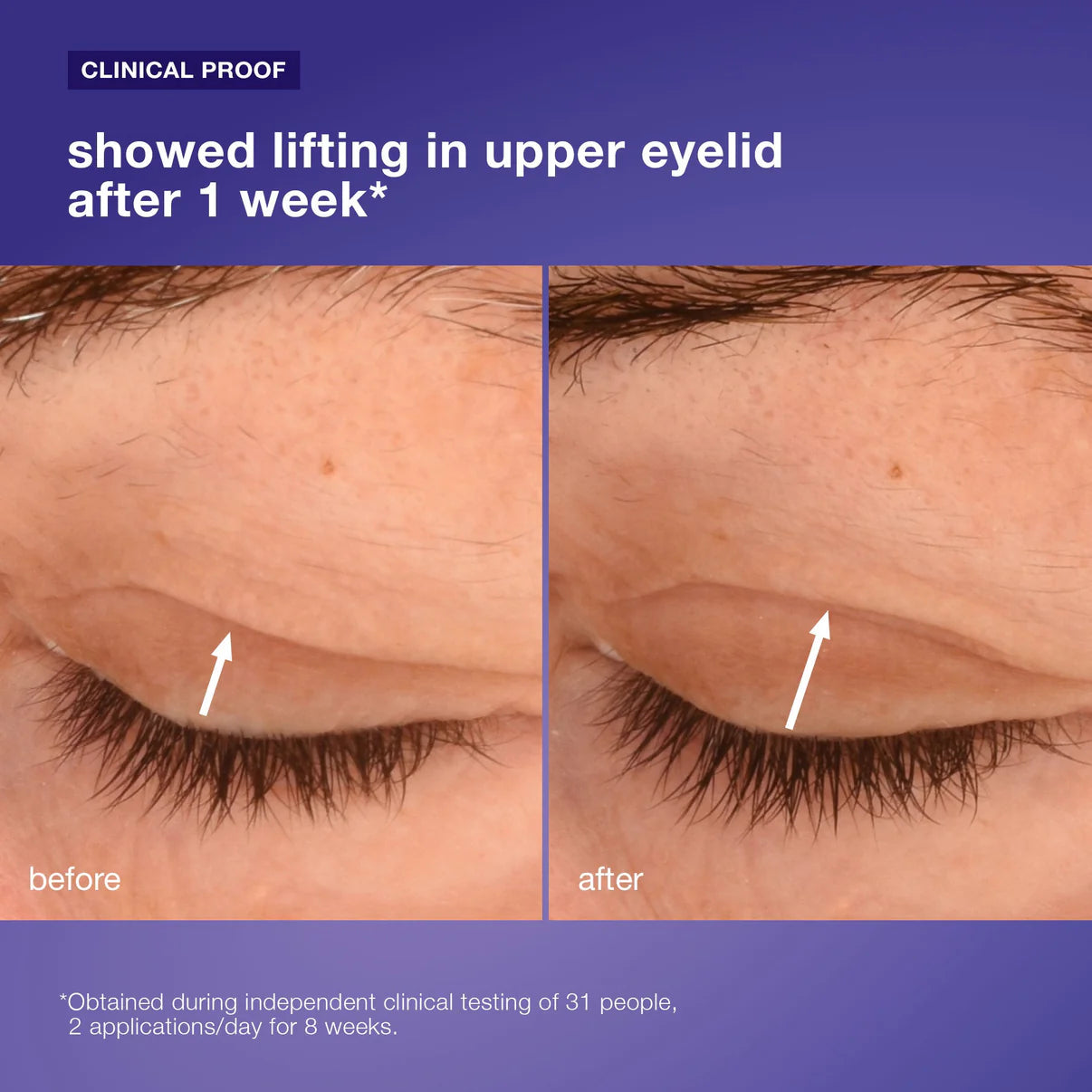 phyto nature lifting eye cream