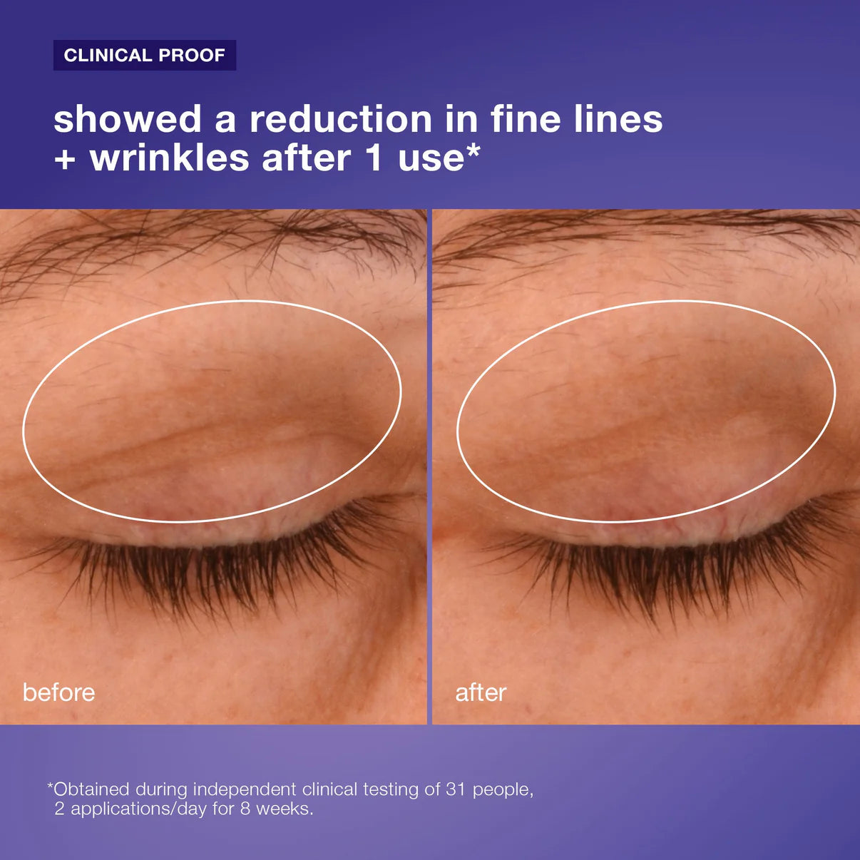 phyto nature lifting eye cream