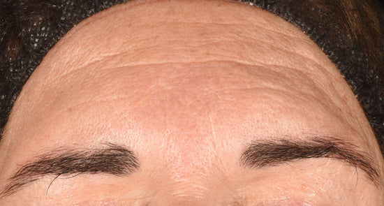 phyto nature e2 reveal – Dermalogica CA