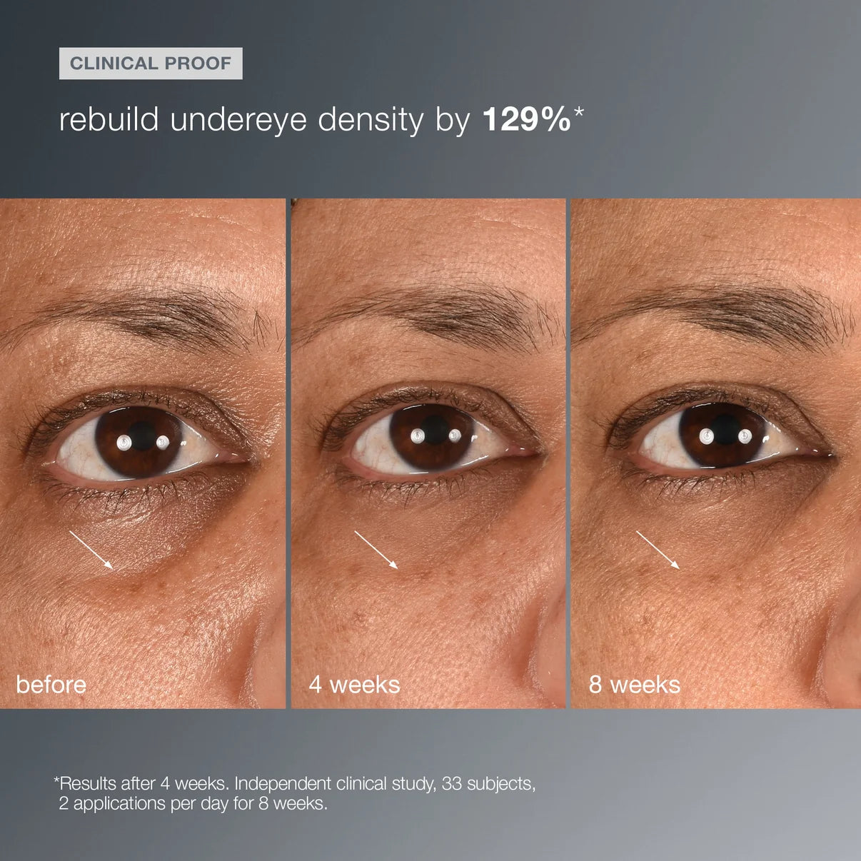 COMING SOON! smart eye density serum