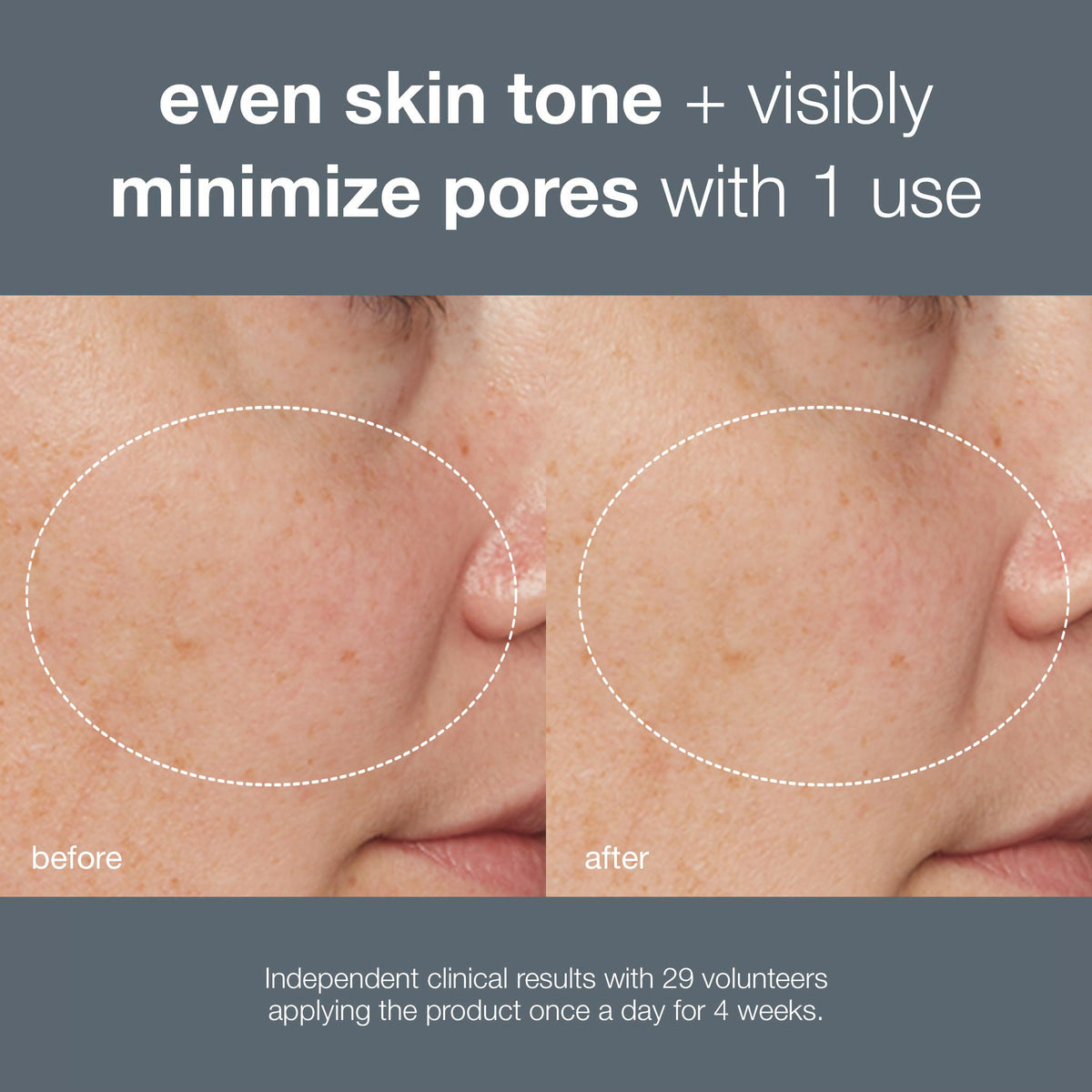 liquid peelfoliant