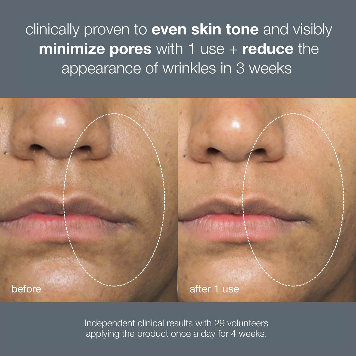 liquid peelfoliant