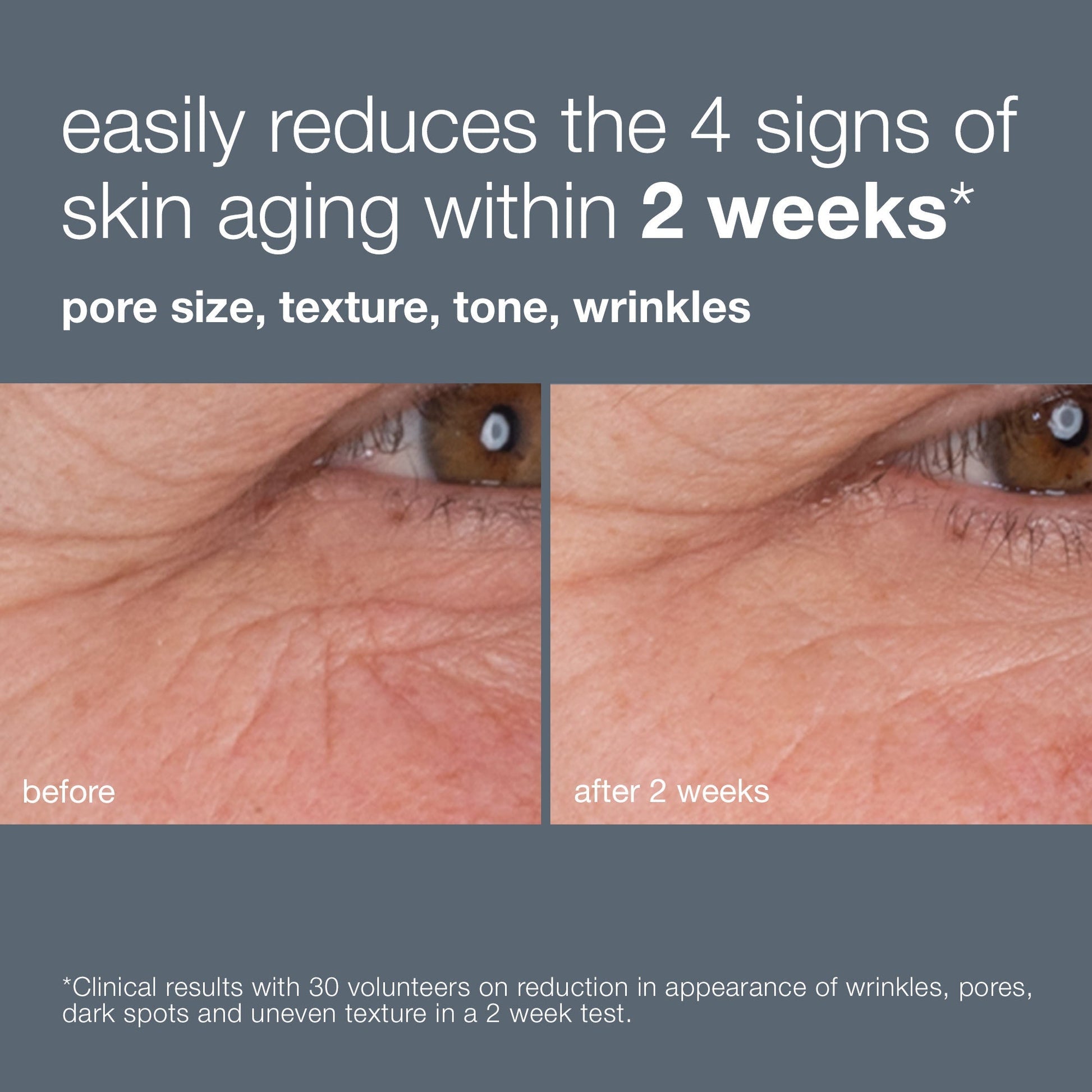 easily reduces the 4 signs of skin aging within 2 weeks. pore size, texture, tone and wrinkles